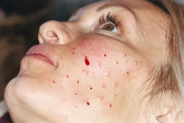 Liverpool Botox Aesthetics Clinic